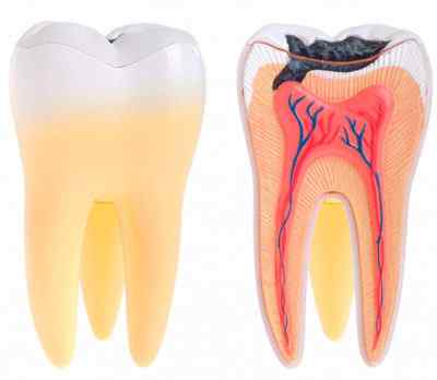 Воспаление пульпы – пульпит